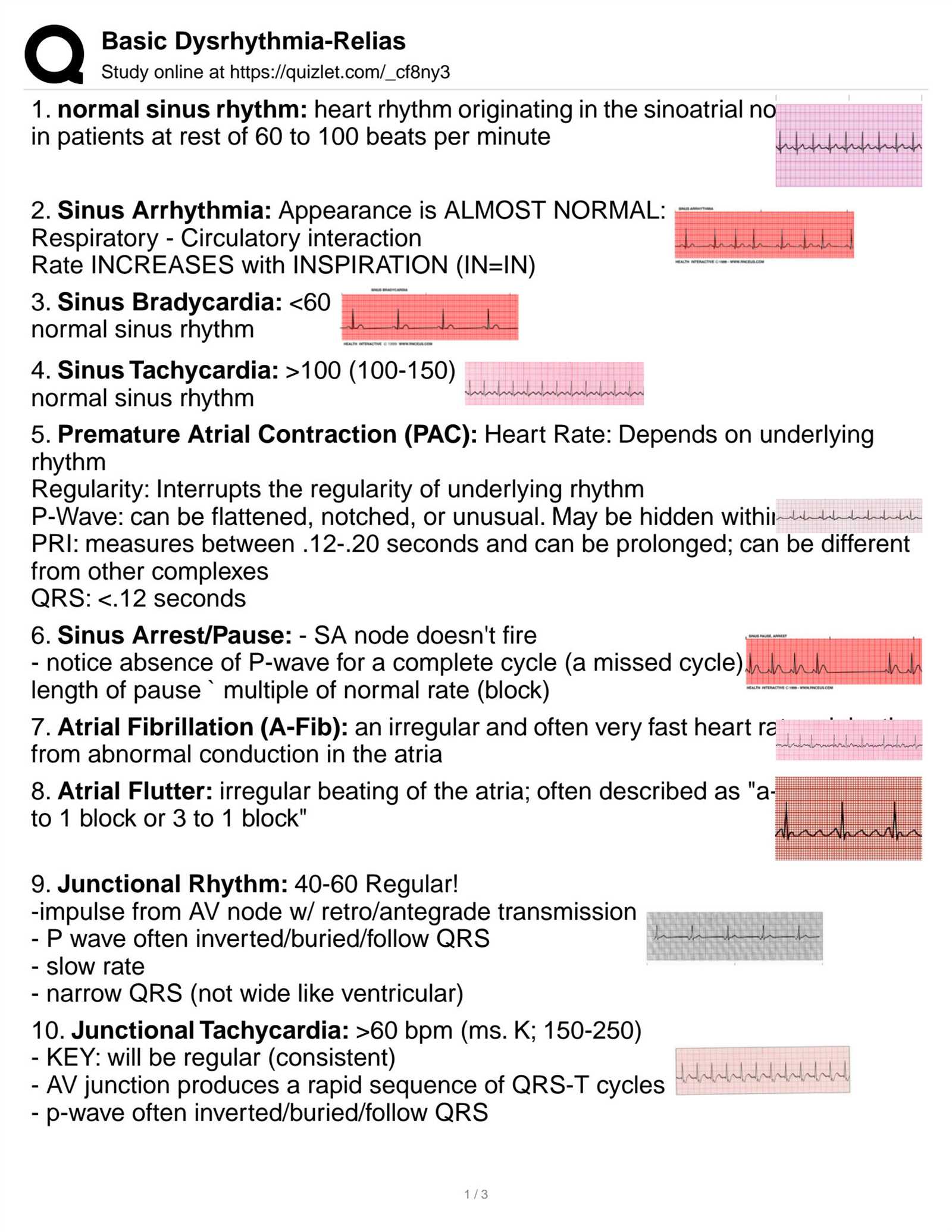 aacn identifying dysrhythmias exam answers