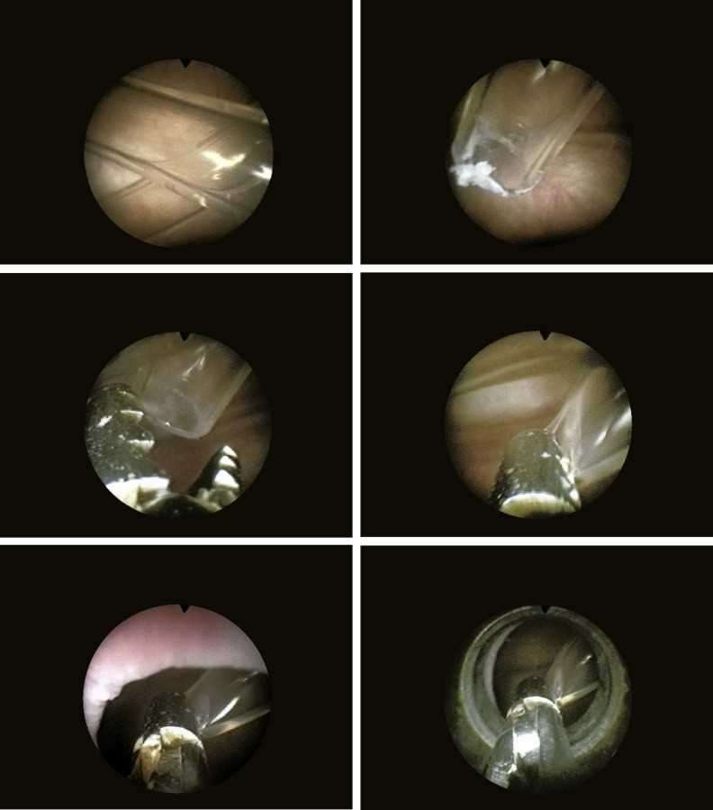 instrument used to examine interior of bladder