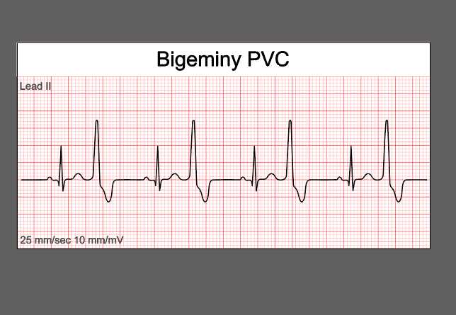 ekg national certification exam practice test