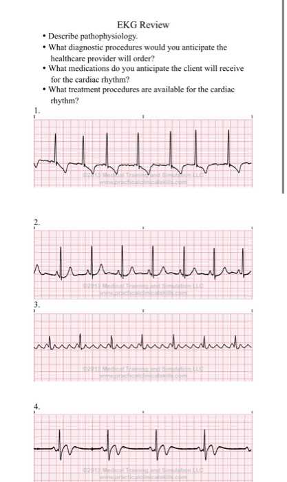 ekg practice exam with answers