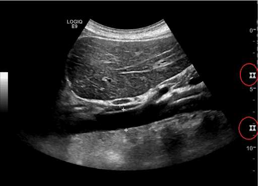 spi ultrasound exam questions