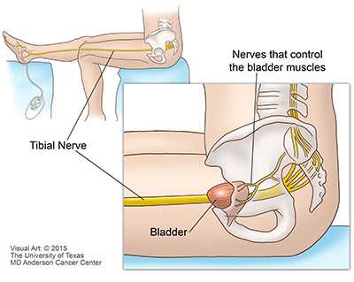 visual exam of the bladder