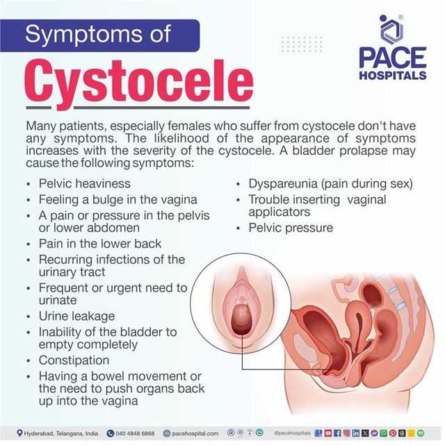 visual exam of the bladder