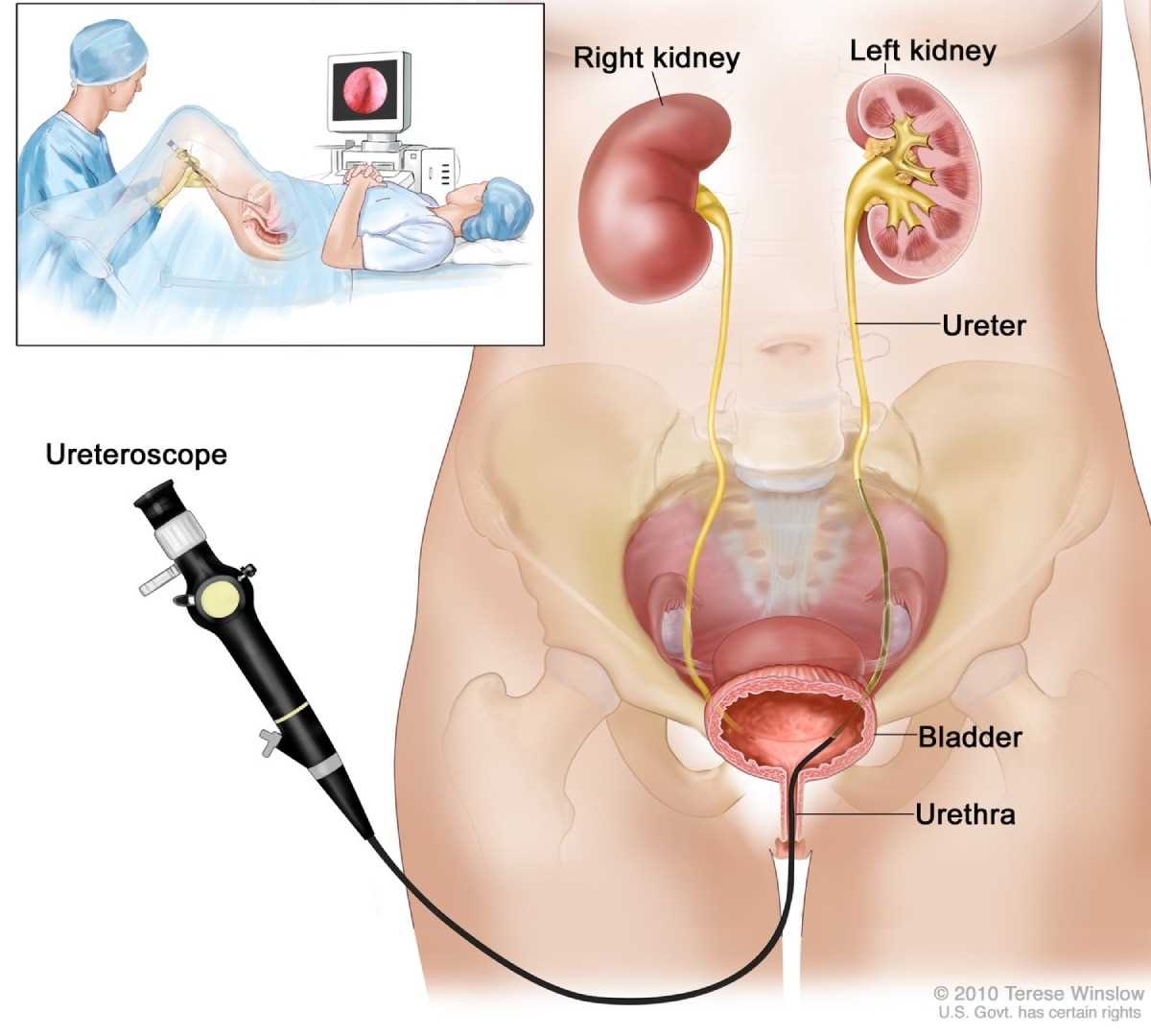 visual exam of the bladder