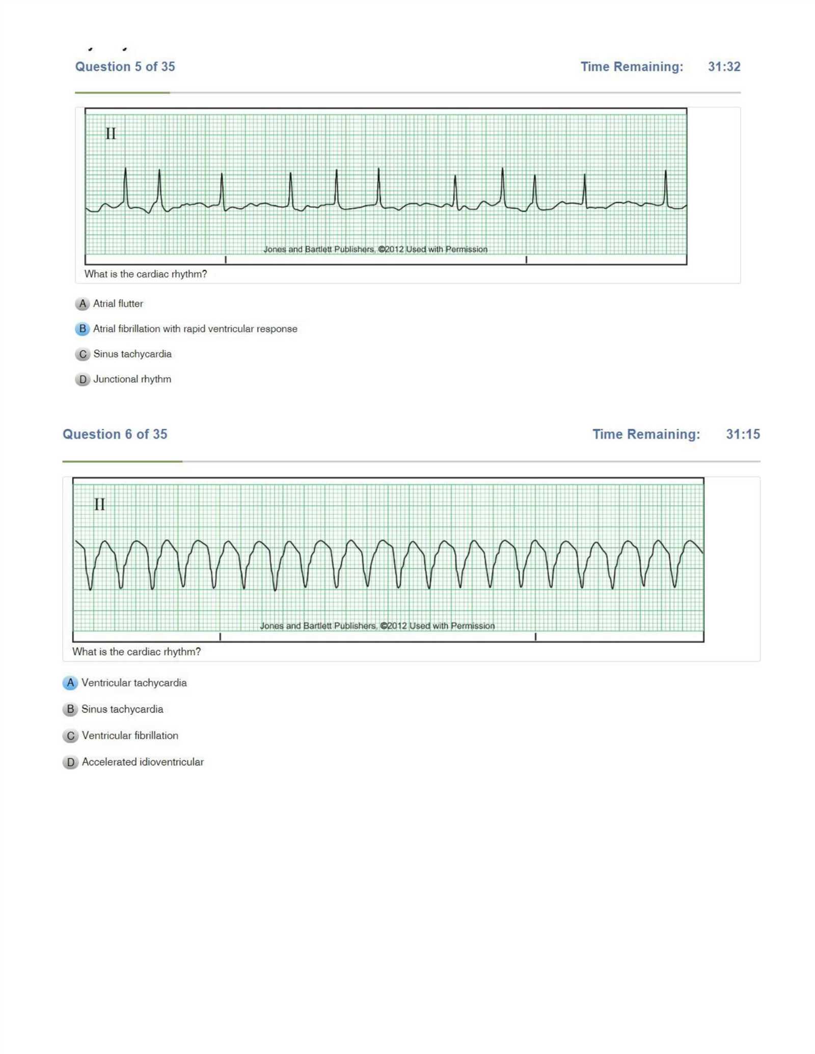 aacn identifying dysrhythmias exam answers