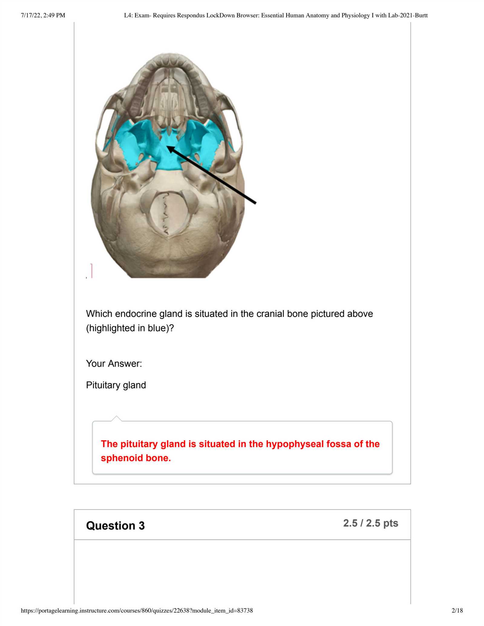 anatomy and physiology lab exam