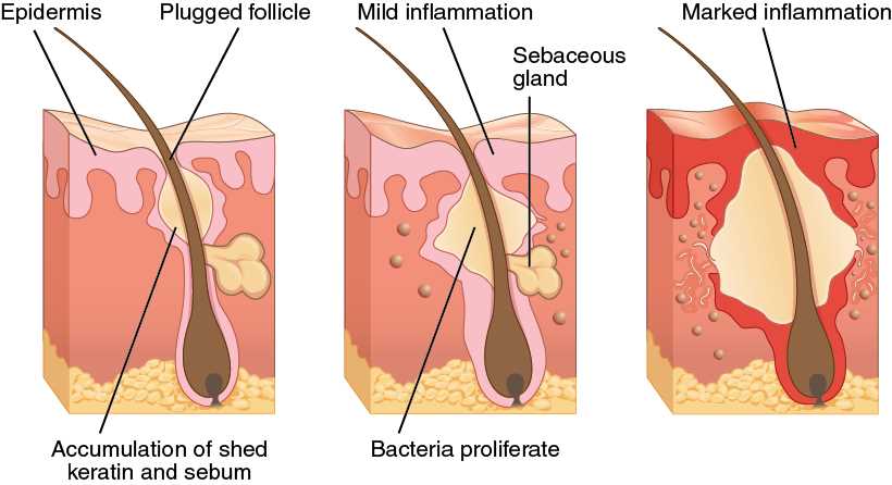 chapter 5 the integumentary system answers