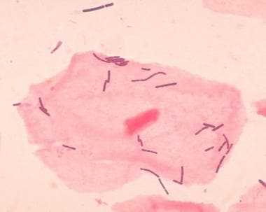 visual exam of the bladder