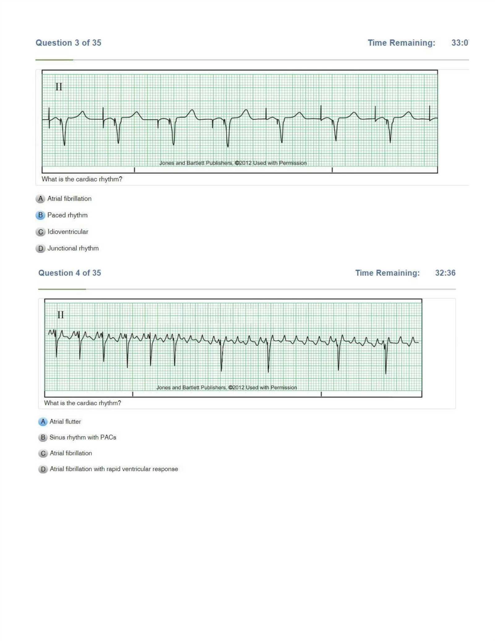 rn.com dysrhythmia exam answers