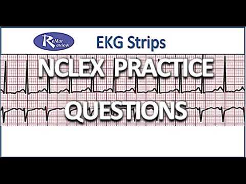 ekg practice exam with answers