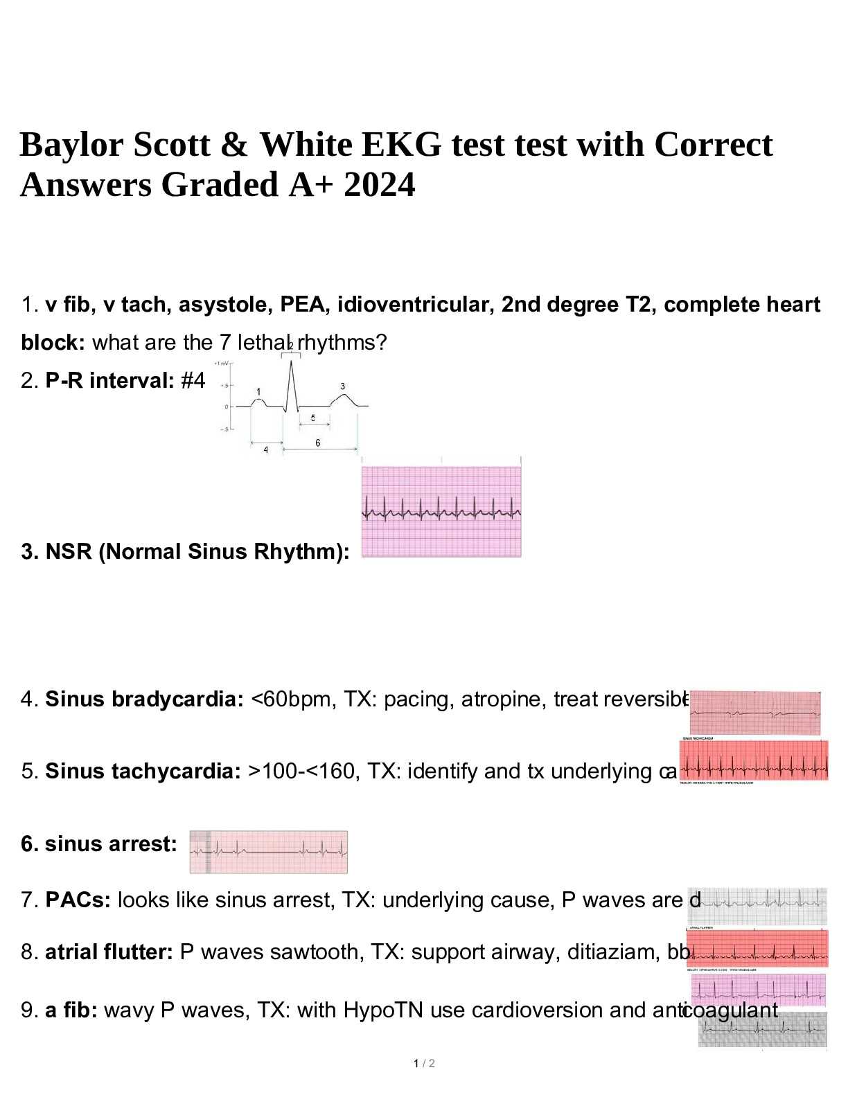 ekg practice exam with answers