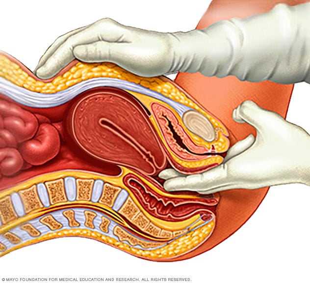 pelvic exam tutorial