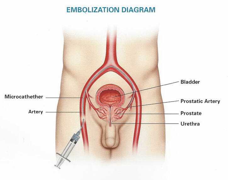 the answers to the prostate exam