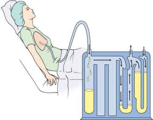 prometric exam questions for nurses