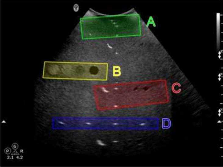 spi ultrasound exam questions