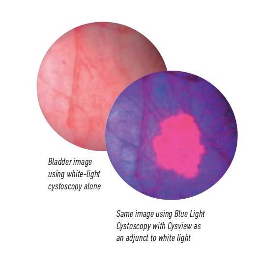 visual exam of the bladder