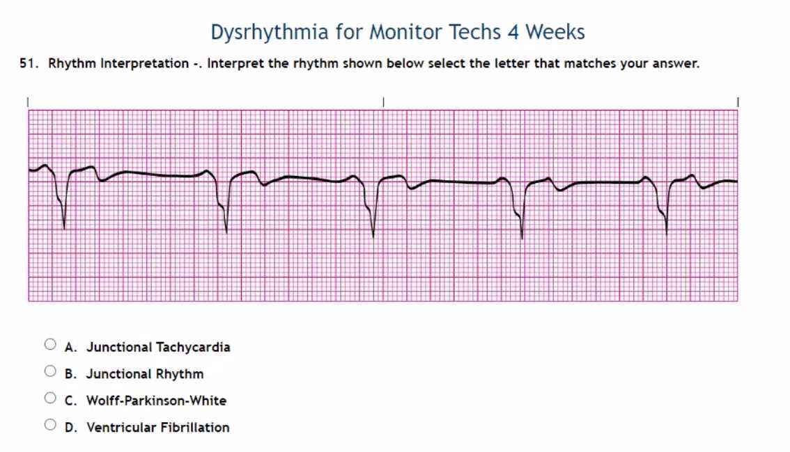 upstate medical university ekg rhythm interpretation exam answers