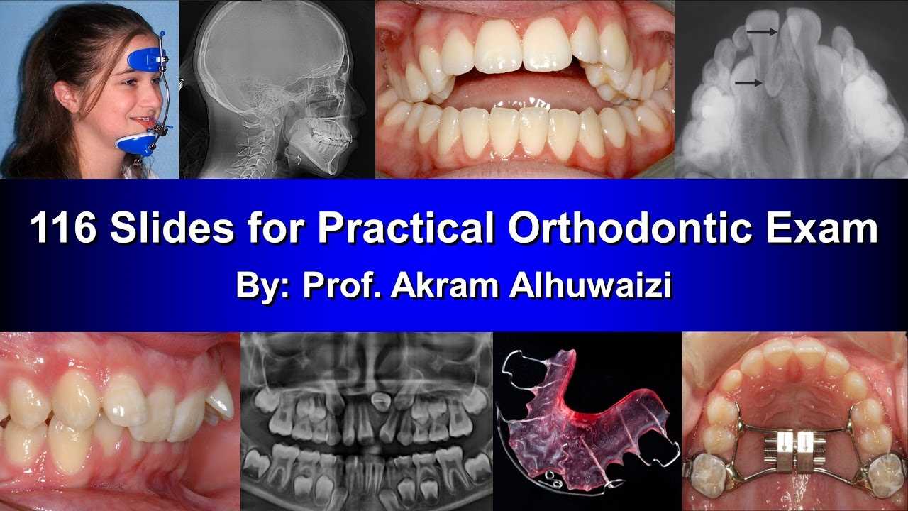 orthodontic exam questions and answers