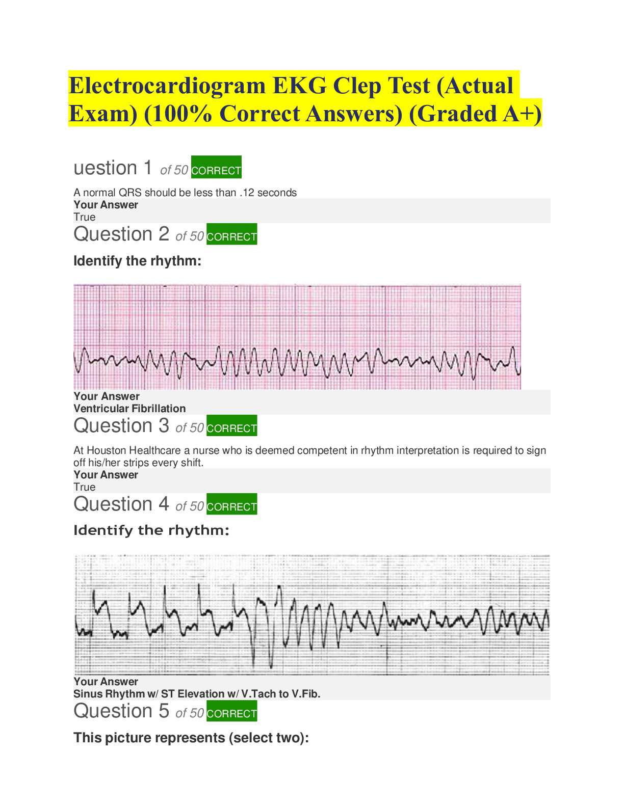 rn.com dysrhythmia exam answers