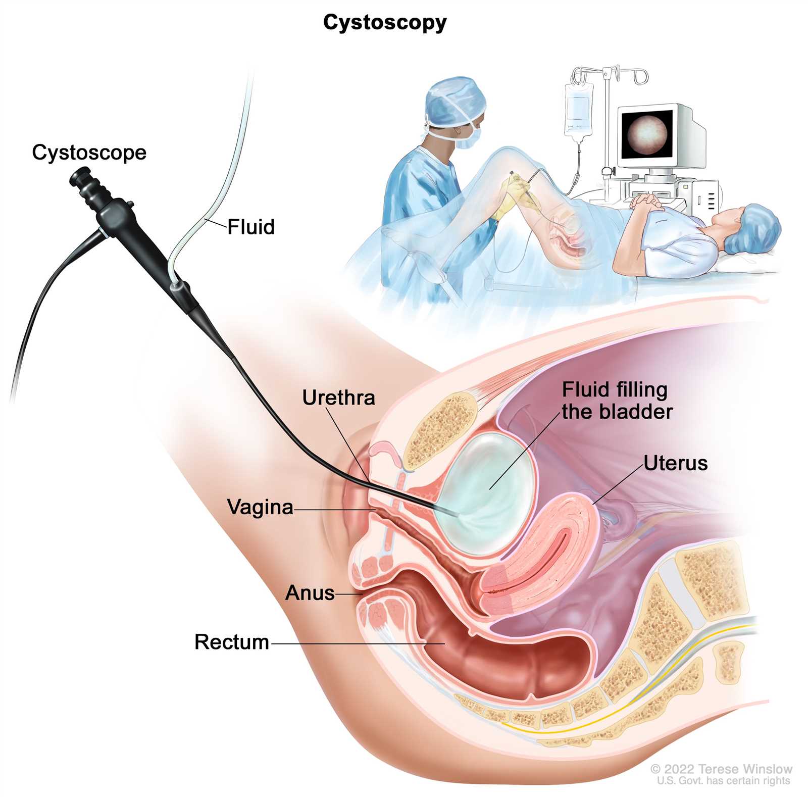 visual exam of the bladder