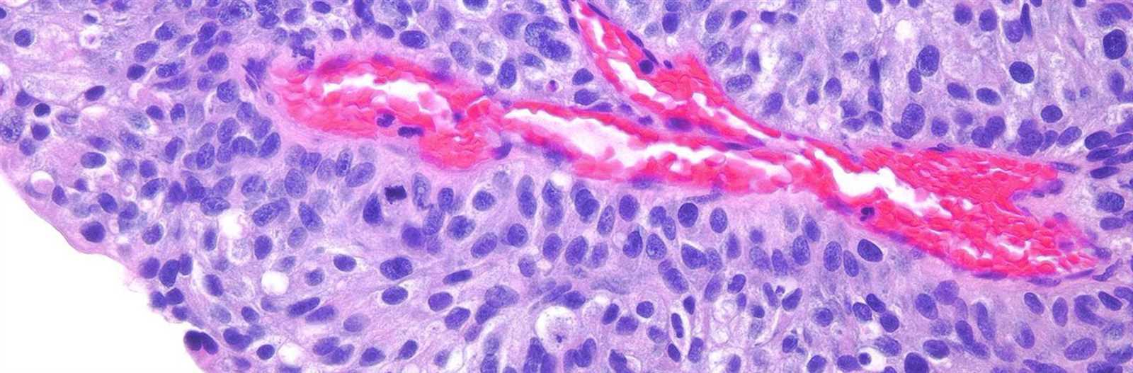 visual exam of the bladder